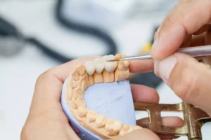 Dental-crowns-same-day-scaled.jpeg